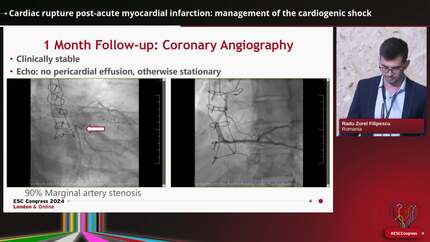 Mechanical circulatory support