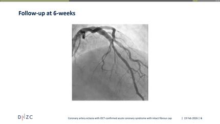 Presentation thumbnail