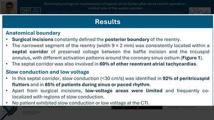 Electrophysiological mechanisms of typical atrial flutter after atrial switch operation : critical role of the septal corridor