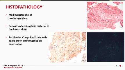 Presentation thumbnail