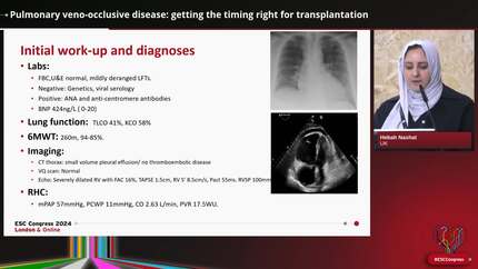 Pulmonary hypertension (2)