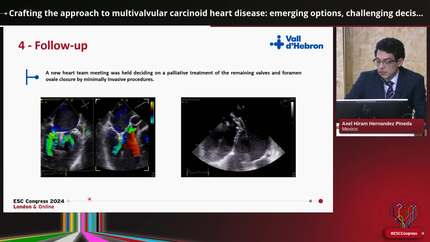 Systemic diseases affecting the heart