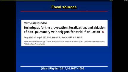 Approach for mapping and ablation in persistent AF patients.