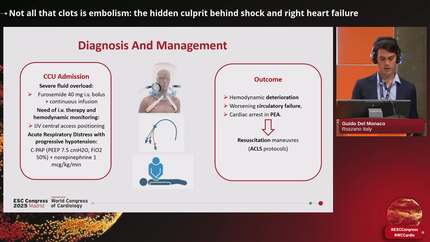 Not all that clots is embolism: the hidden culprit behind shock and right heart failure