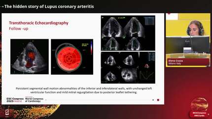 Presentation thumbnail