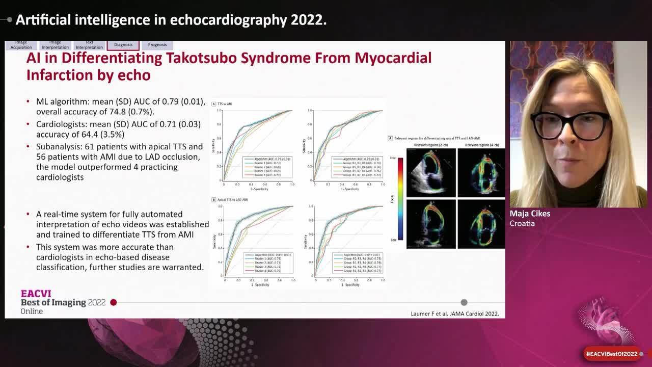 Artificial intelligence in echocardiography 2022.