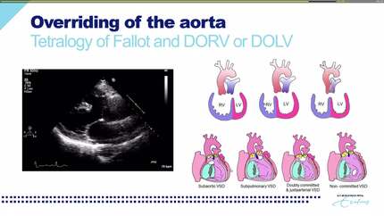 Presentation thumbnail