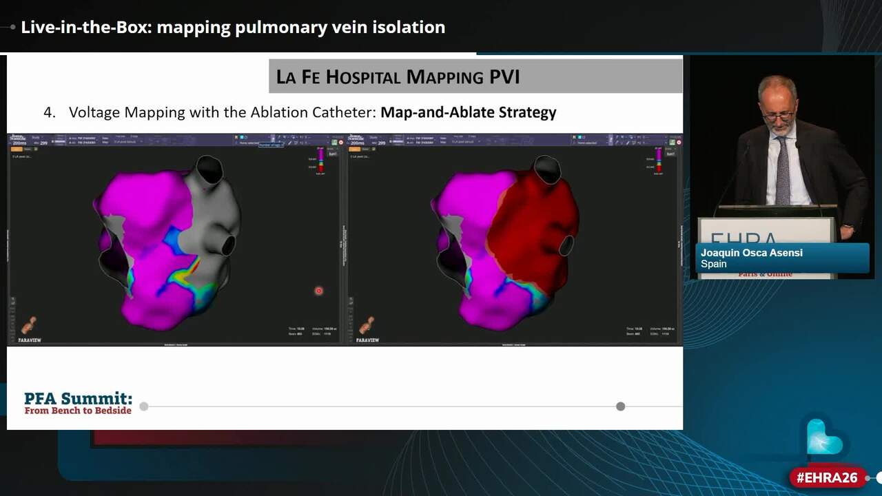 Live-in-the-Box: mapping pulmonary vein isolation