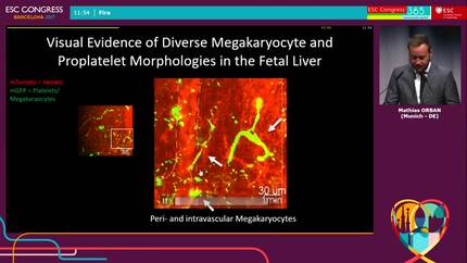 Advanced intra-embryonic in vivo imaging reveals distinct patterns of platelet generation from megakaryocytes in the fetal liver of transgenic mice