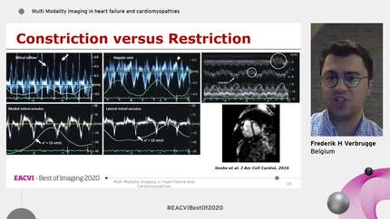 Presentation thumbnail