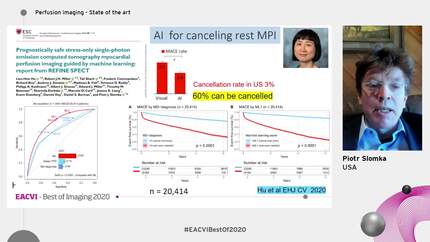 How will AI transform myocardial perfusion imaging.