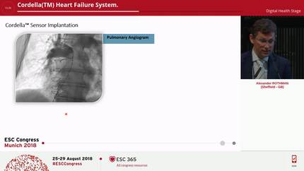 Cordella(TM) Heart Failure System.