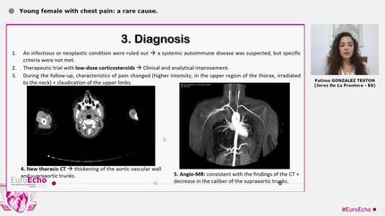 Young female with chest pain: a rare cause.