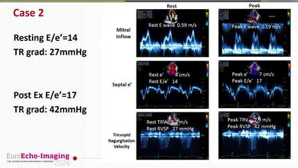 Presentation thumbnail