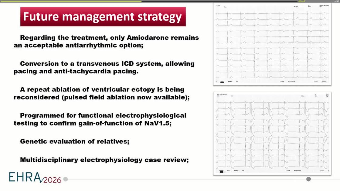 ESC 365 - When ventricular ectopy becomes a disease: unmasking a sodium ...