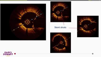 Presentation thumbnail