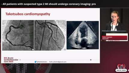 Controversies regarding the universal definition of MI