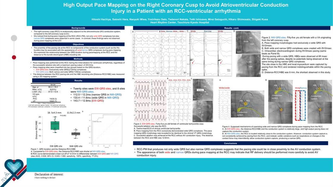 ESC 365 - High output pace mapping on the right coronary cusp to avoid ...