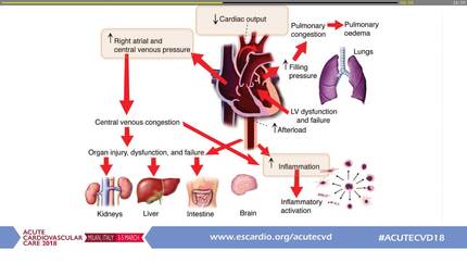 Acute heart failure and deteriorating renal function: how do I balance treatment against renal dysfunction?  Case-based presentation.