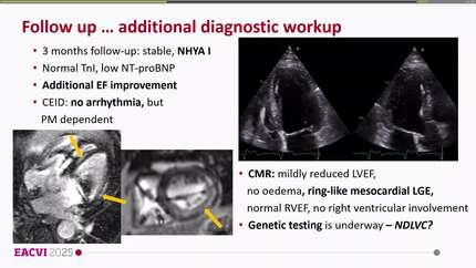 Complete heart block in the setting of Takotsubo syndrome:  when a broken heart skips a beat