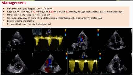 New onset heart failure: multimodality imaging to the rescue