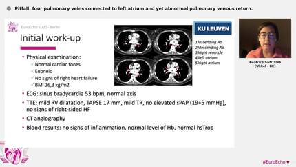 Pitfall: four pulmonary veins connected to left atrium and yet abnormal pulmonary venous return.