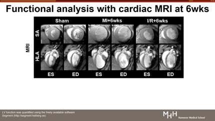 Targeting chemokine receptor CXCR4 after myocardial infarction by PET for image-guided anti-inflammatory therapy