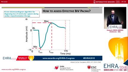 How to assess effective biventricular capture