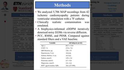 Biophysics-inspired deep learning for improved denoising in ventricular signals in ischemic cardiomyopathy