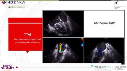 Presentation thumbnail