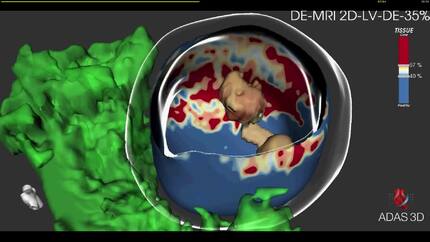 Presentation thumbnail