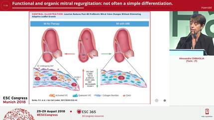 Functional and organic mitral regurgitation: not often a simple differentiation.