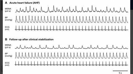 Sympathetic nervous system drive assessed by direct muscle sympathetic nerve activity in heart failure: first direct human evidence of sympathetic neural surge during acute heart failure