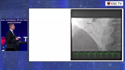 The flying circus of coronary angiography and intervention: all the findings you always wanted to see and some you never even knew existed
