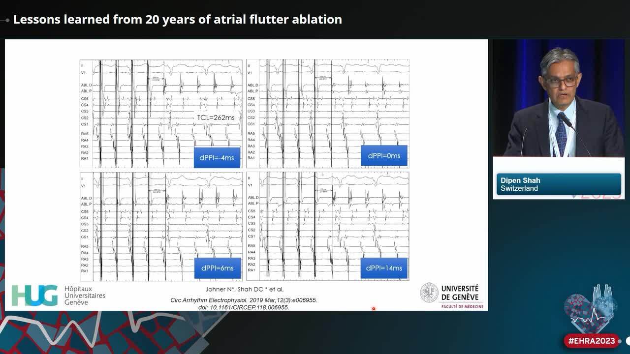 Lessons learned from 20 years of atrial flutter ablation