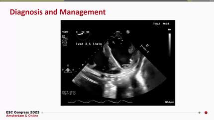 Presentation thumbnail