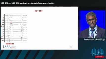 Presentation thumbnail