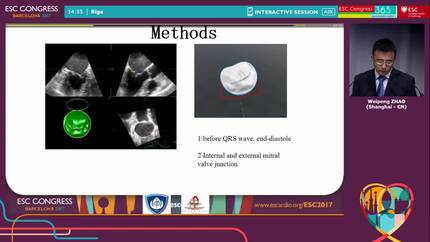 Hybrid 3D printing based on fusion of multi-modality imaging in simulation of catheter-based transapical mitral valve artificial chordae implantation