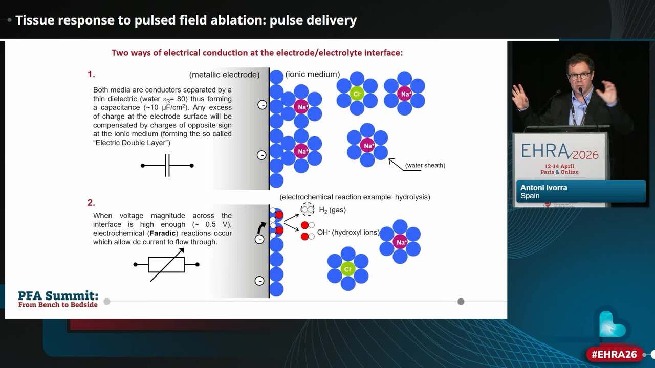 The basics of pulsed field ablation