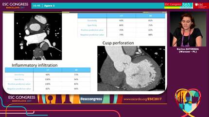 The usefulness of cardiac computed tomography  in the diagnosis of infective endocarditis and its perivalvular complications