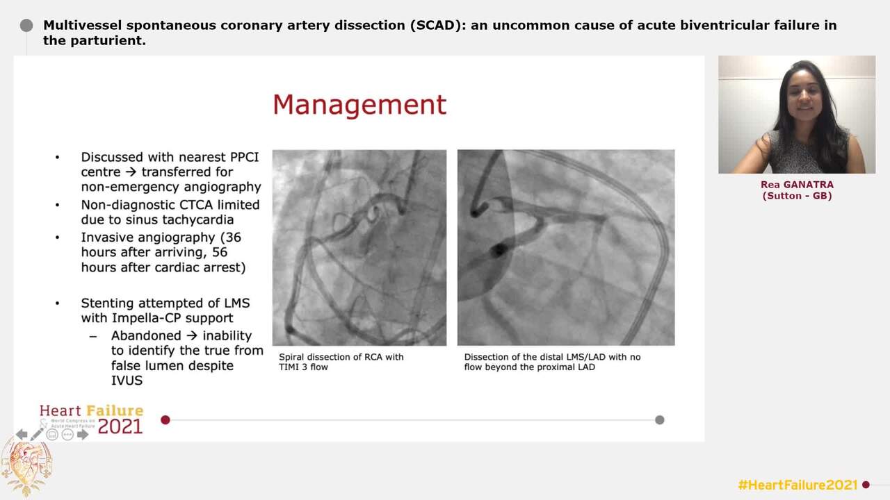 Multivessel spontaneous coronary artery dissection (SCAD): an uncommon cause of acute biventricular failure in the parturient.