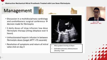 Obstructive Mechanical Mitral Prosthesis Treated with Low Dose Fibrinolysis.