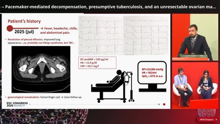 Pacemaker-mediated decompensation, presumptive tuberculosis, and an unresectable ovarian mass in a young woman with single-ventricle physiology and pulmonary arterial hypertension