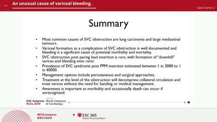 An unusual cause of variceal bleeding.
