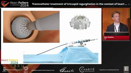 Interventional therapies in heart failure - from the left heart side to the right and back