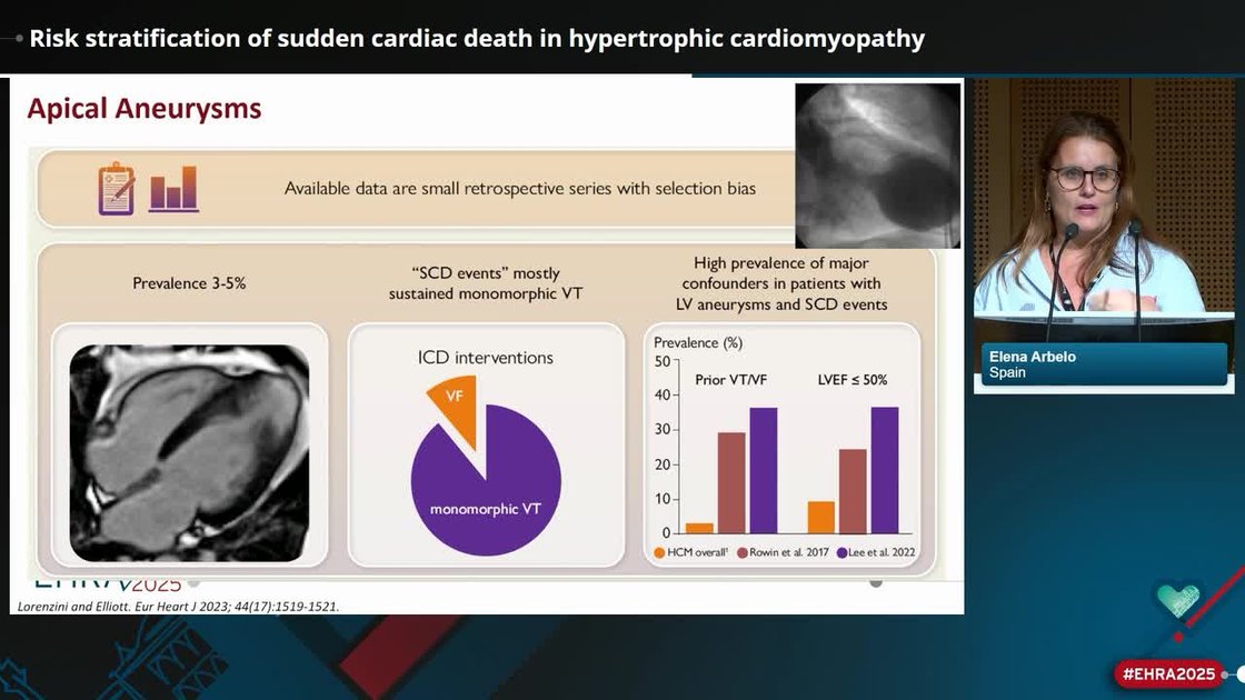 ESC 365 - Risk stratification of sudden cardiac death in hypertrophic ...