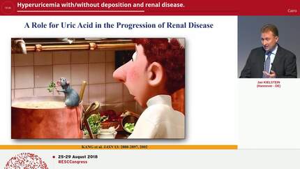 Hyperuricemia with/without deposition and renal disease.