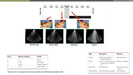 Presentation thumbnail