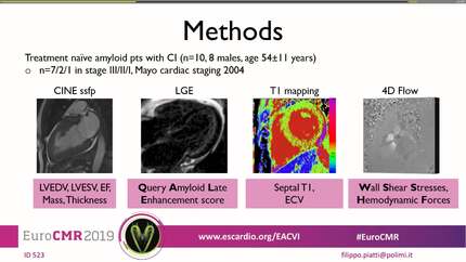 4D flow CMR for diastolic function assessment in cardiac amyloidosis