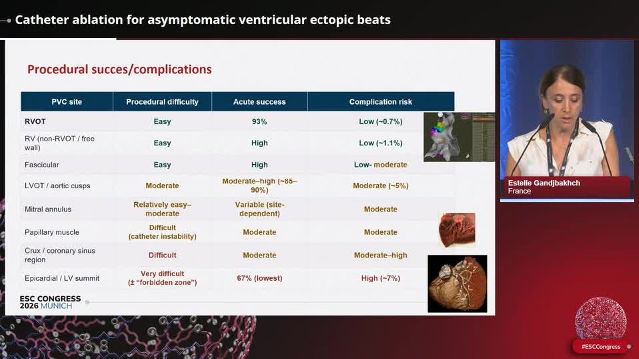 Asymptomatic ventricular ectopic beats: what to do?